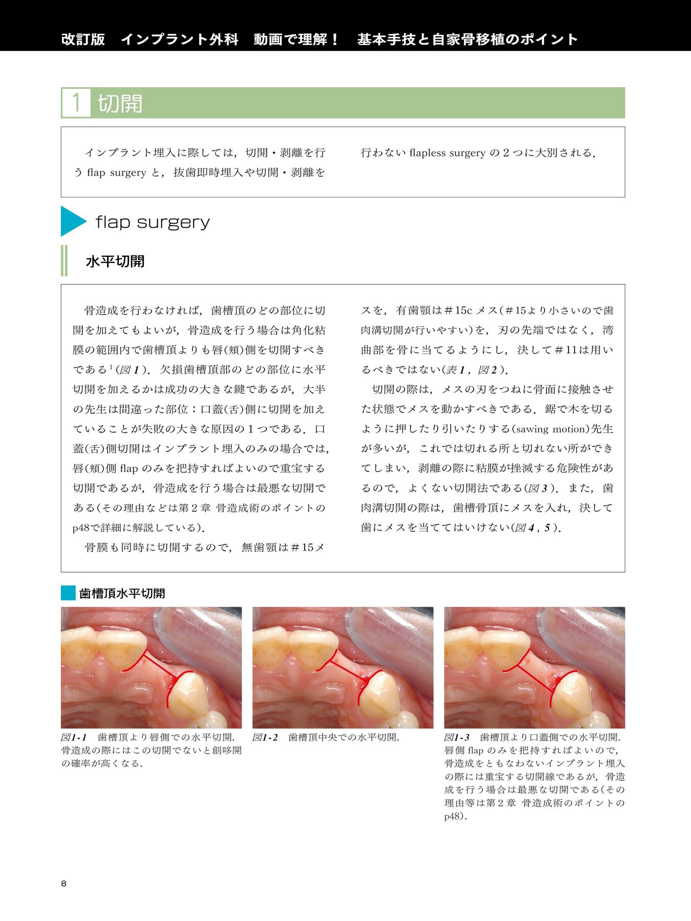 改訂版 インプラント外科