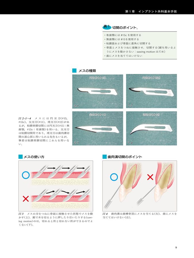 改訂版 インプラント外科