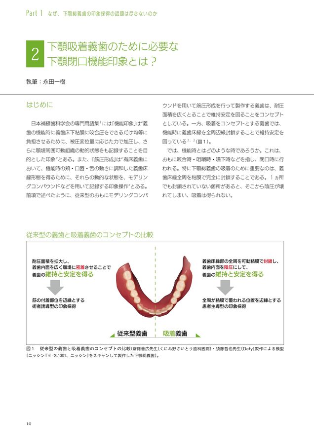 誰にでもできる下顎総義歯の吸着 : カラーアトラス（箱付き） 誰にでも 