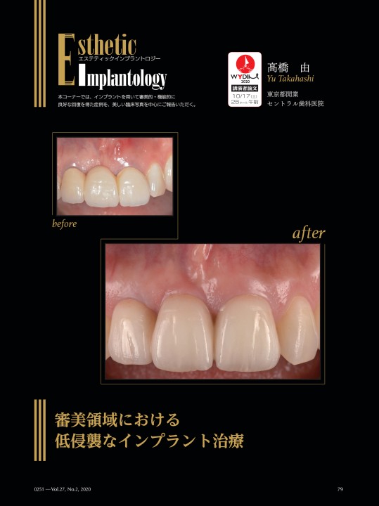 QDI 2020年3月号
