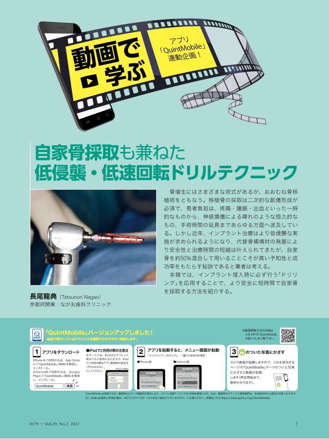 デンタルインプラントロジー2022 全巻 Quintessence DENTAL Implantology 2023年No.2