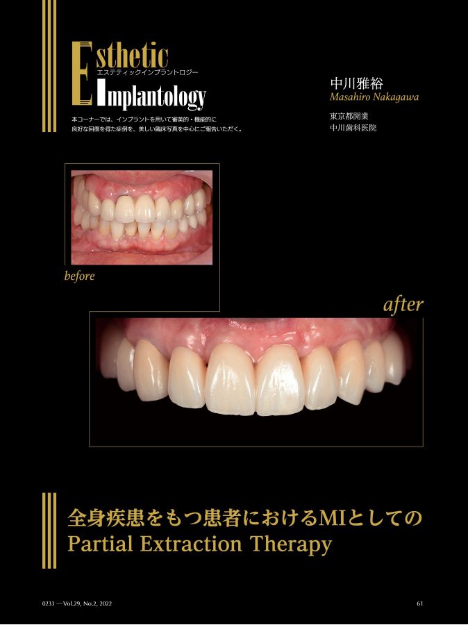 クインテッセンス出版 Quintessence DENTAL Implantology