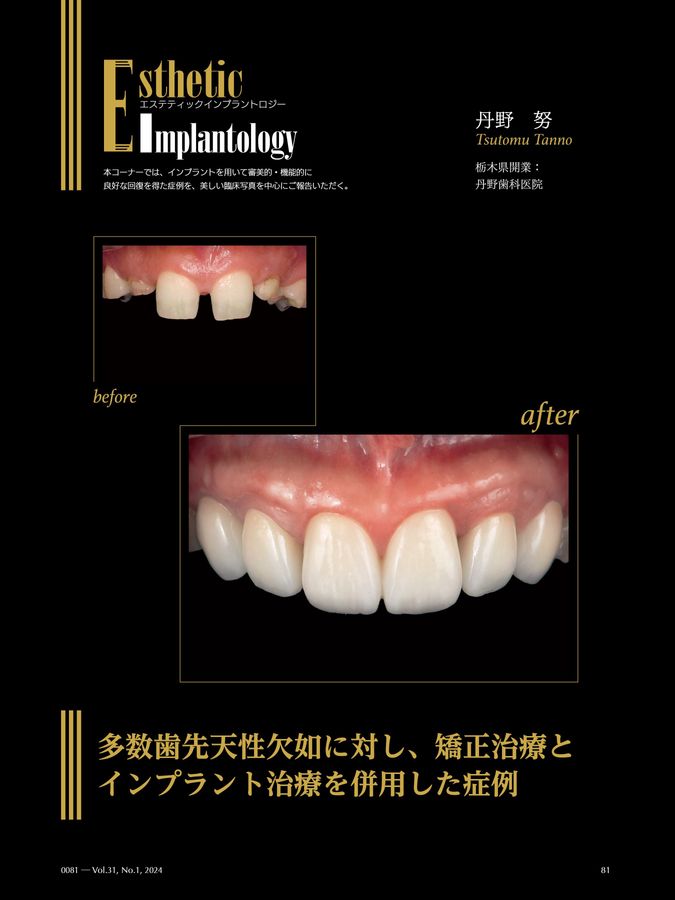インプラントロジー　2024年vol.1〜6全巻セット Quintessence DENTAL Implantology 2024年No.1