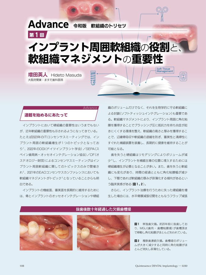 Quintessence DENTAL Implantology 2024年No.2