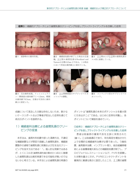 隔月刊 補綴臨床 2012年1.3.5.7.9.11月 QDT 2020年7月号