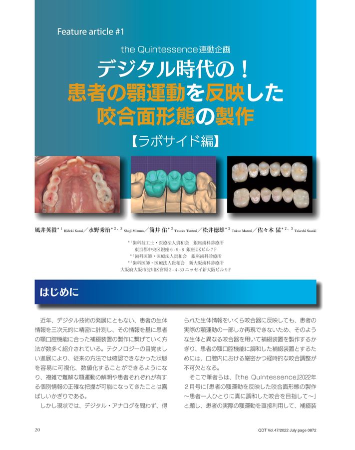 ⚠裁断済 咬合の臨床応用 : アナログからデジタルまで ☆ 日本