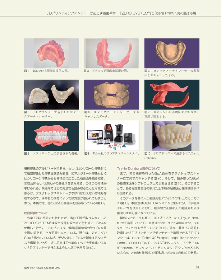 ⚠裁断済　咬合の臨床応用 : アナログからデジタルまで　☆ 2024年11月のピックアップ書籍 | Dental Life Design