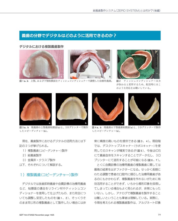 コピーデンチャーズ?複製義歯の製作とその活用法 COPY DENTURES コピー