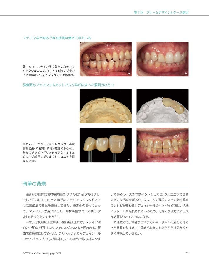 2024年　QDT 1〜12月 QDT 2024年12月号 - クインテッセンス出版