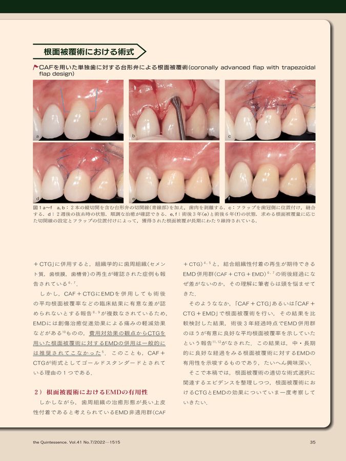 ザ・クインテッセンス 2022年7月号