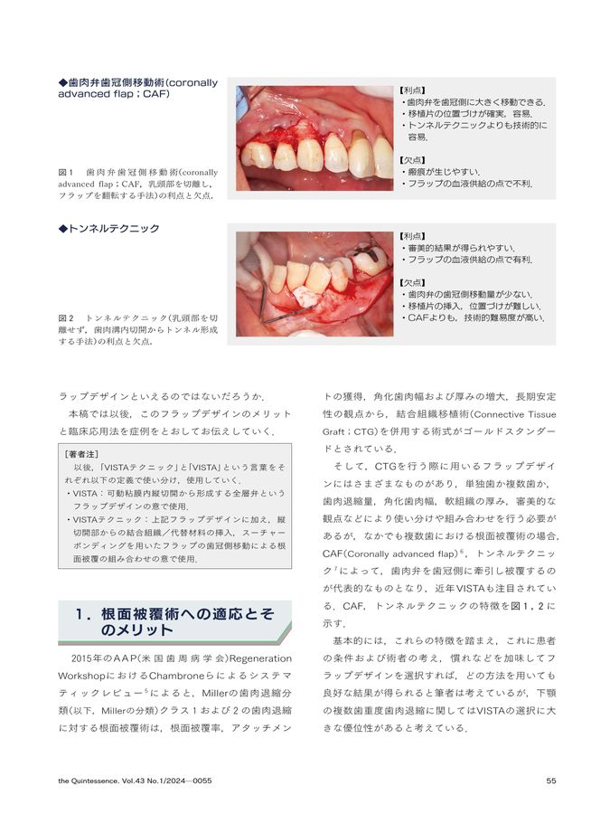 Quintessence ザクインテッセンス2024年1年分 ザ・クインテッセンス 2024年8月号 - クインテッセンス出版