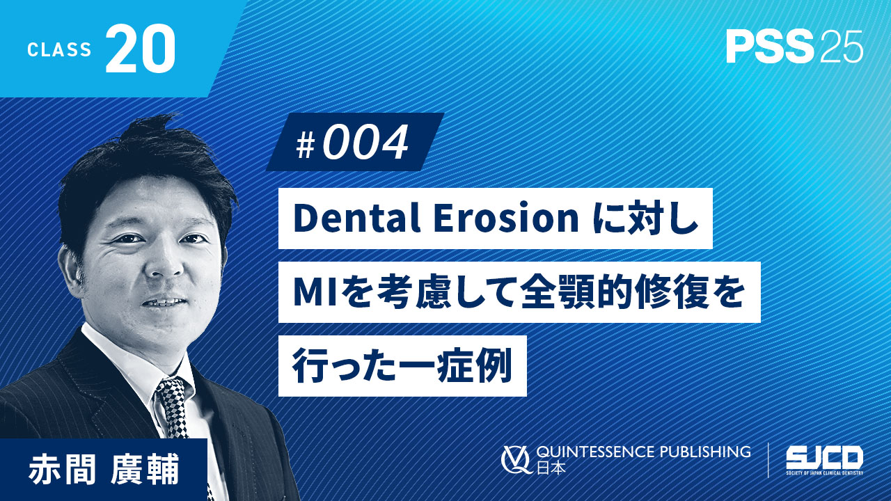 20-4_Dental Erosion に対しMIを考慮して全顎的修復を行った一症例_赤間 廣輔