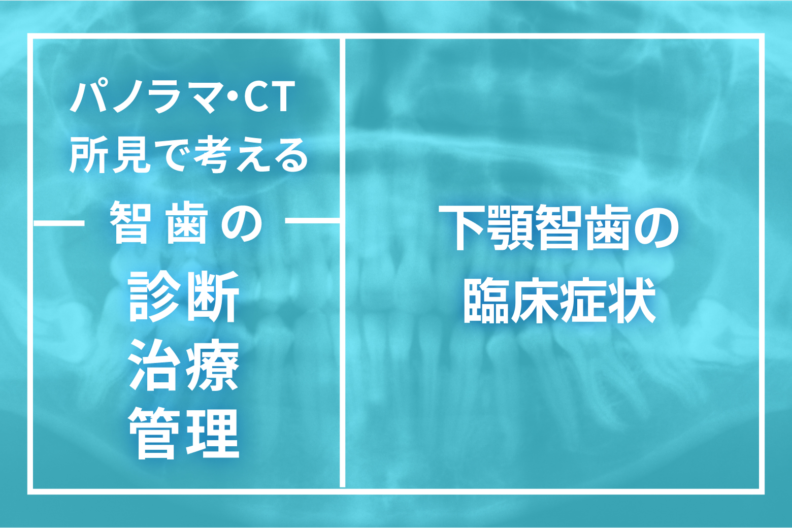 第1回 下顎智歯の臨床症状