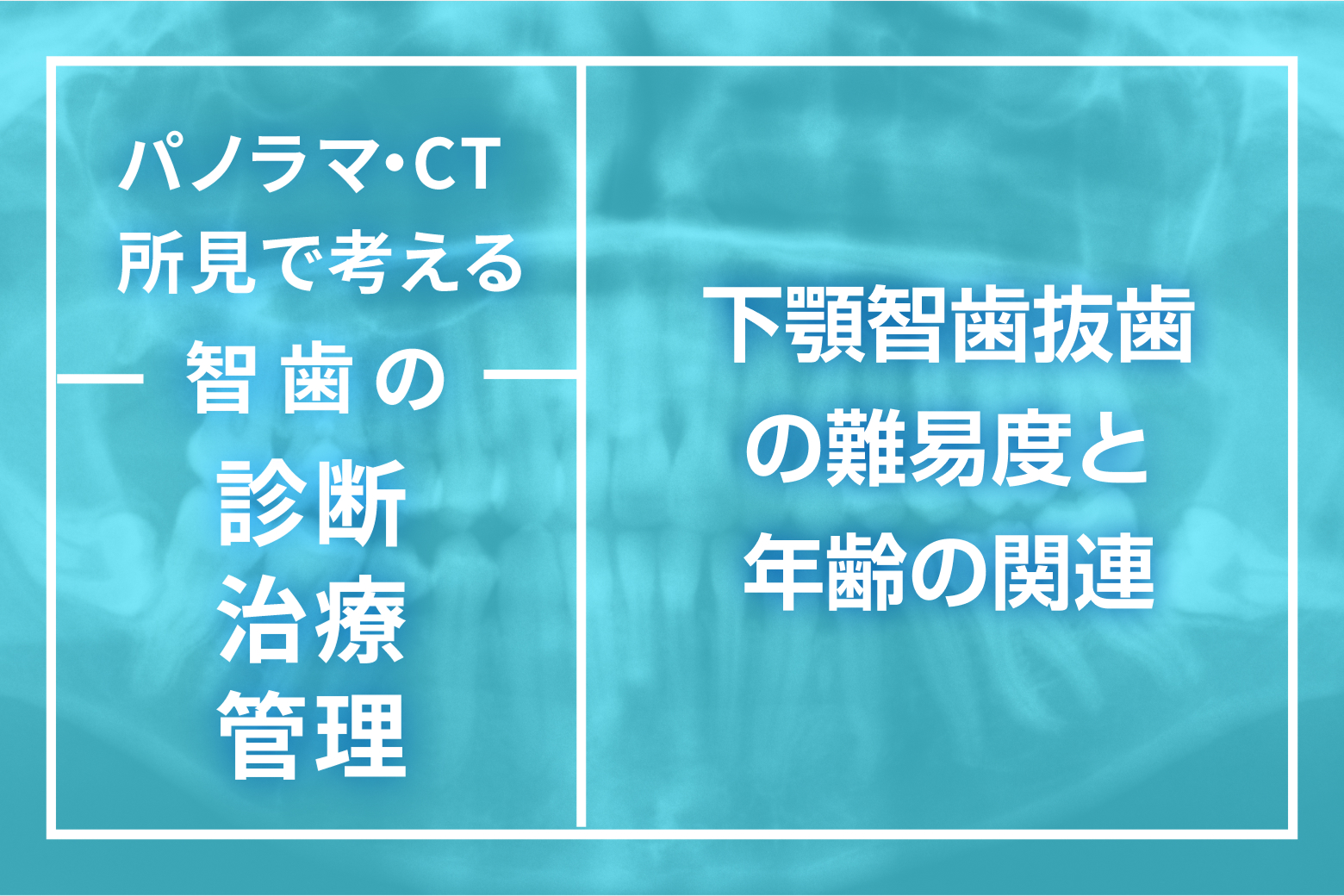 第4回 下顎智歯抜歯の難易度と年齢の関連