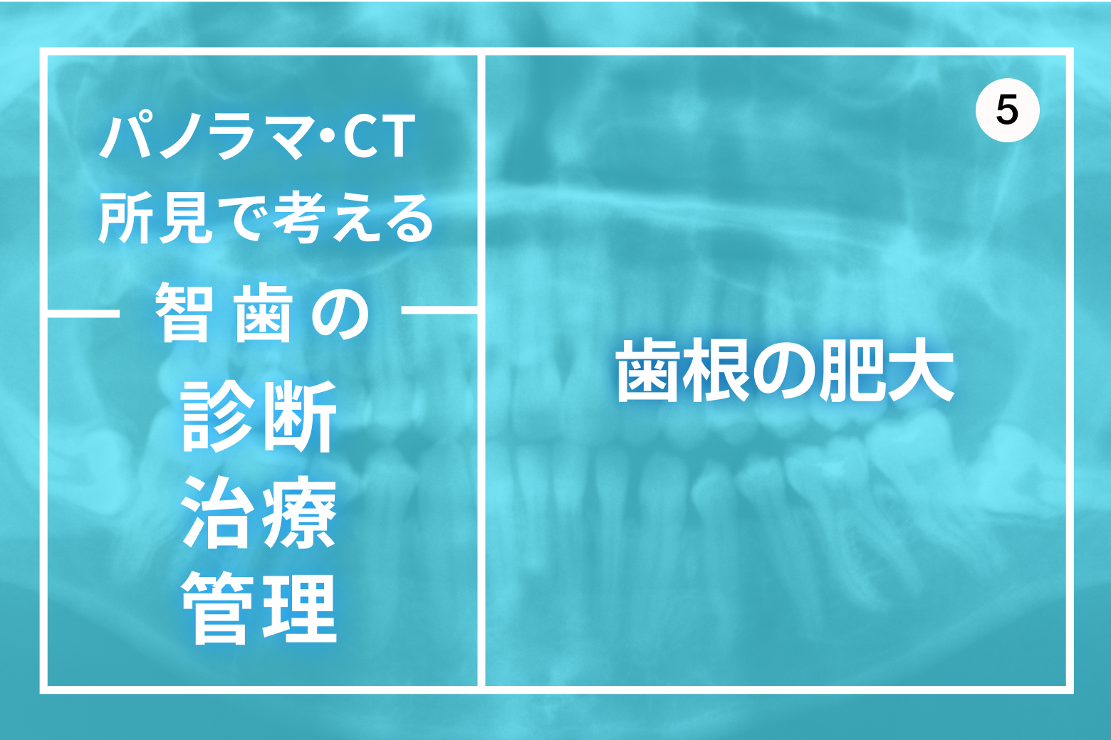 第5回 歯根の肥大