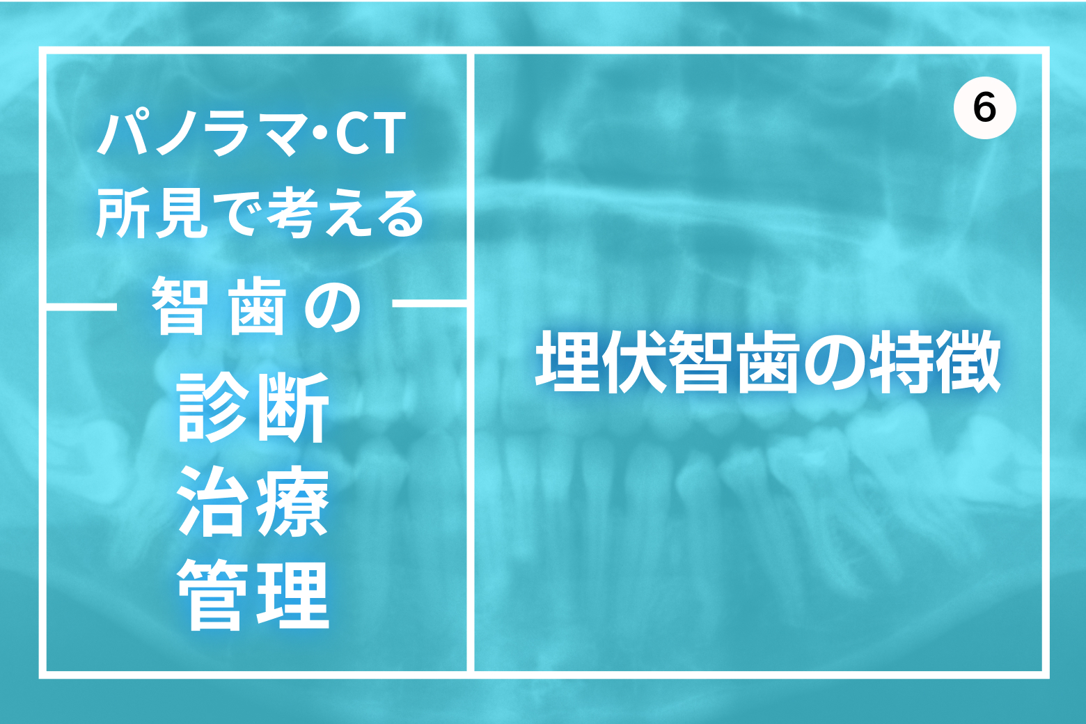 第6回 埋伏智歯の特徴