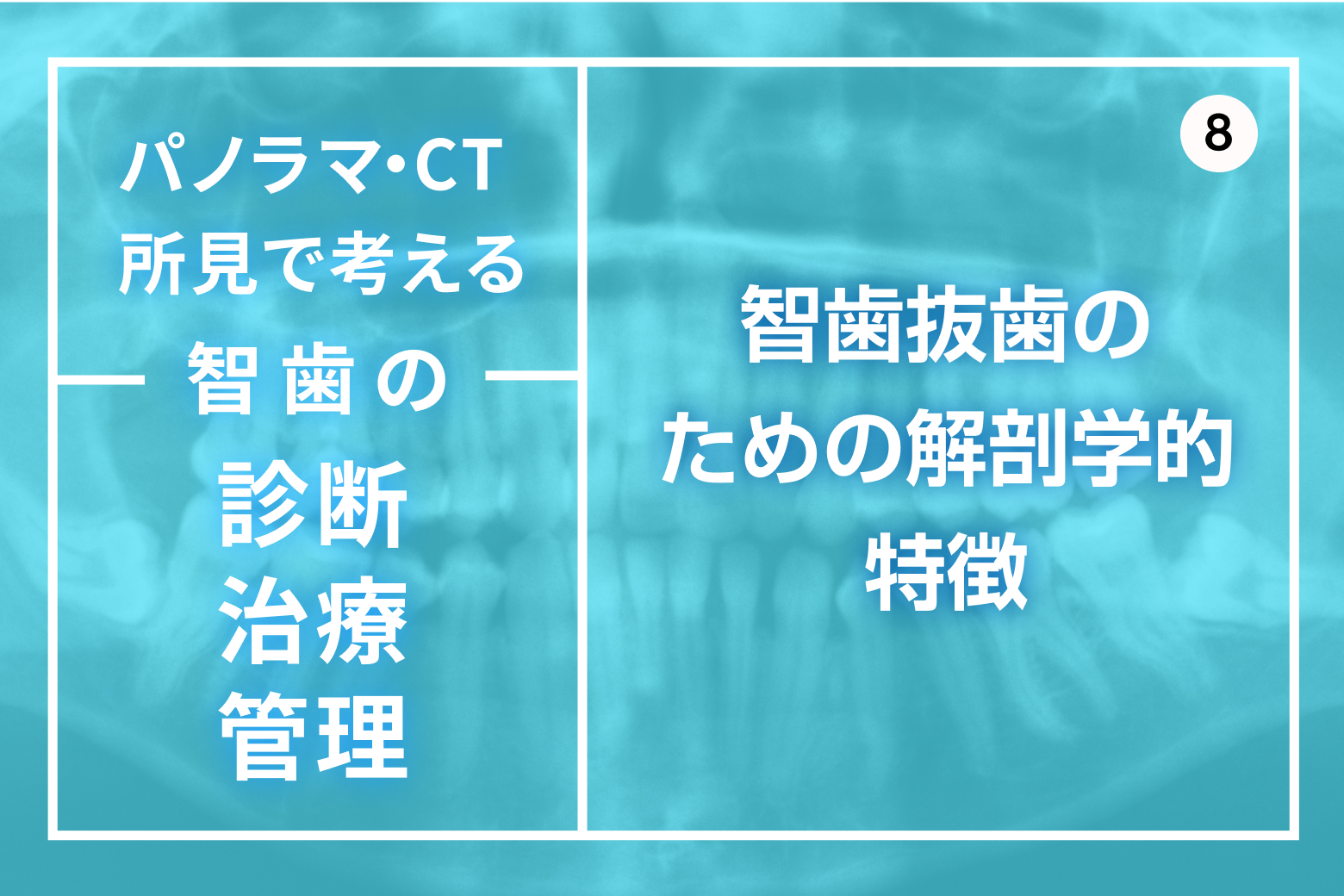 第8回 智歯抜歯のための解剖学的特徴