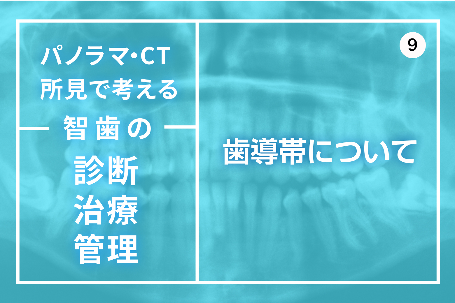 第9回 歯導帯について
