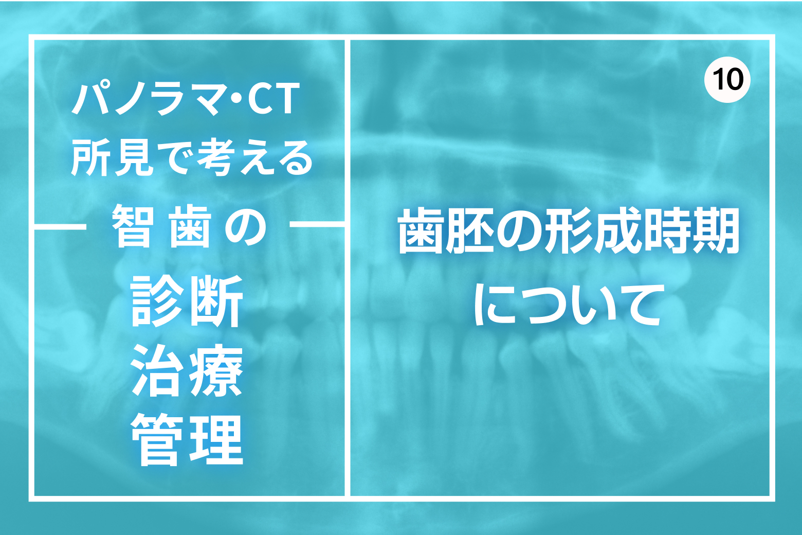 第10回 歯胚の形成時期について