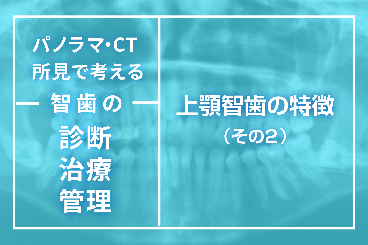 第14回 上顎智歯の特徴（その2）