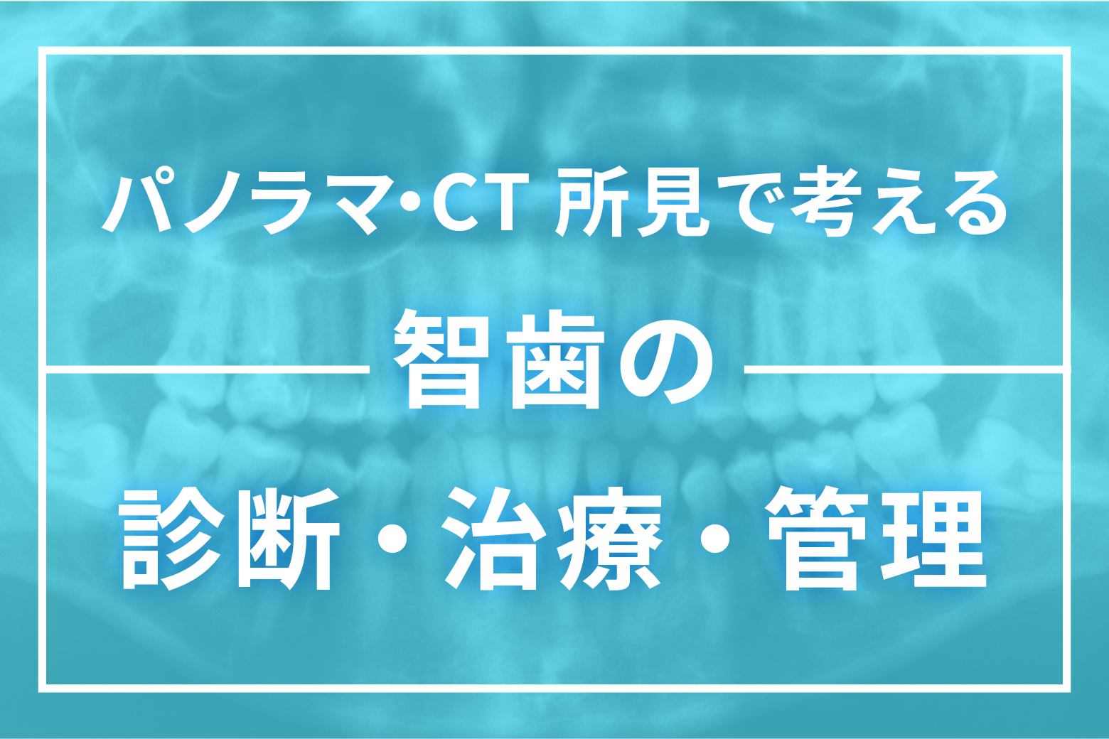 パノラマ・CT所見で考える 智歯の診断・治療・管理