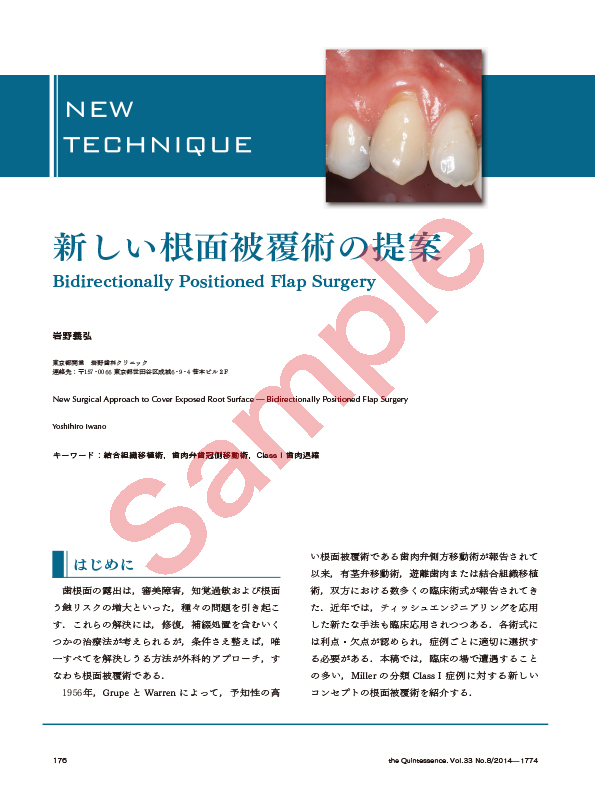 NEW TECHNIQUE 新しい根面被覆術の提案 Bidirectionally