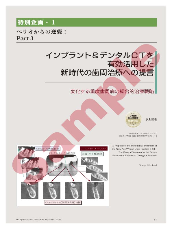 特別企画・1：ペリオからの逆襲！ Part3 インプラント