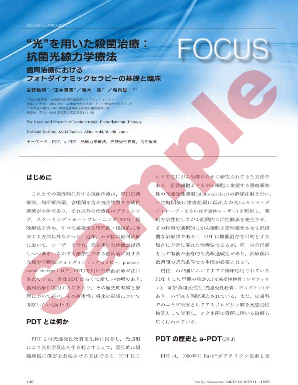 FOCUS：「光」を用いた殺菌治療：抗菌光線力学療法　歯周治療におけるフォトダイナミックセラピーの基礎と臨床
 