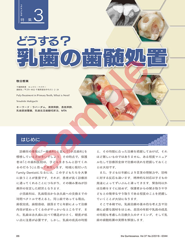 特 集 3 どうする？ 乳歯の歯髄処置 - クインテッセンス出版