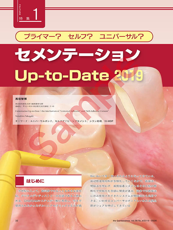 プライマー？　セルフ？　ユニバーサル？ セメンテーションUp-to-Date2019
