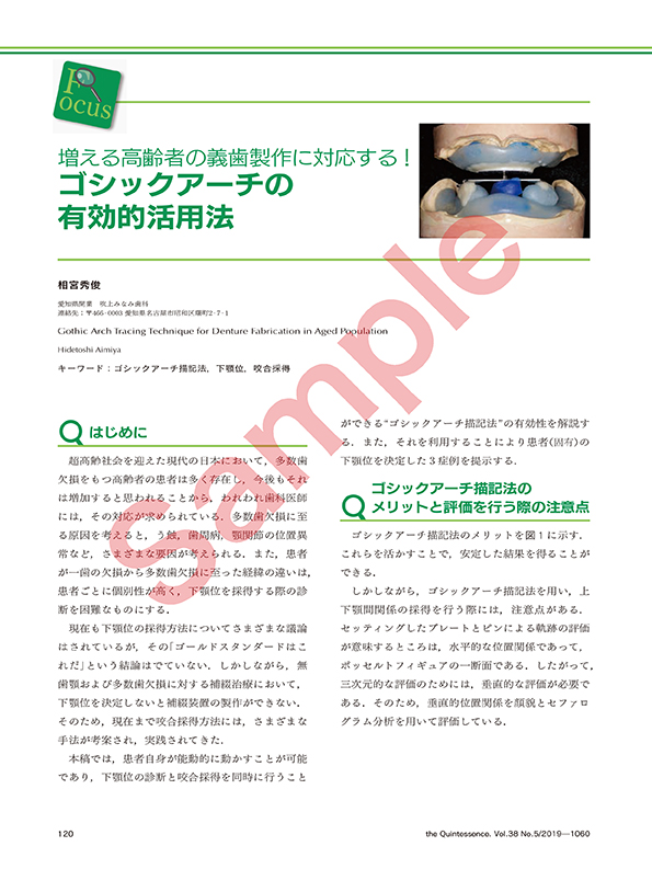 増える高齢者の義歯製作に対応する！　ゴシックアーチの有効的活用法
