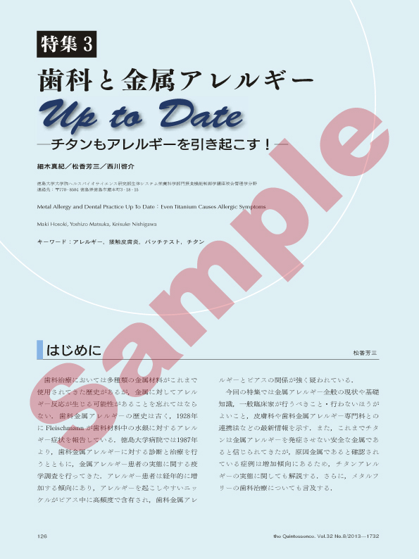 特集3 歯科と金属アレルギー Up to Date チタンもアレルギーを