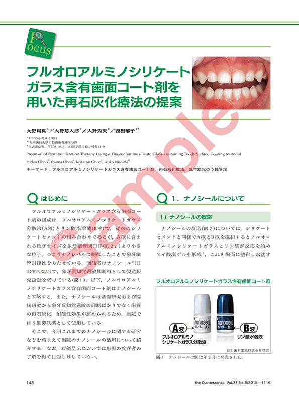 フルオロアルミノシリケートガラス含有歯面コート剤を用いた 再石灰化療法の提案 
