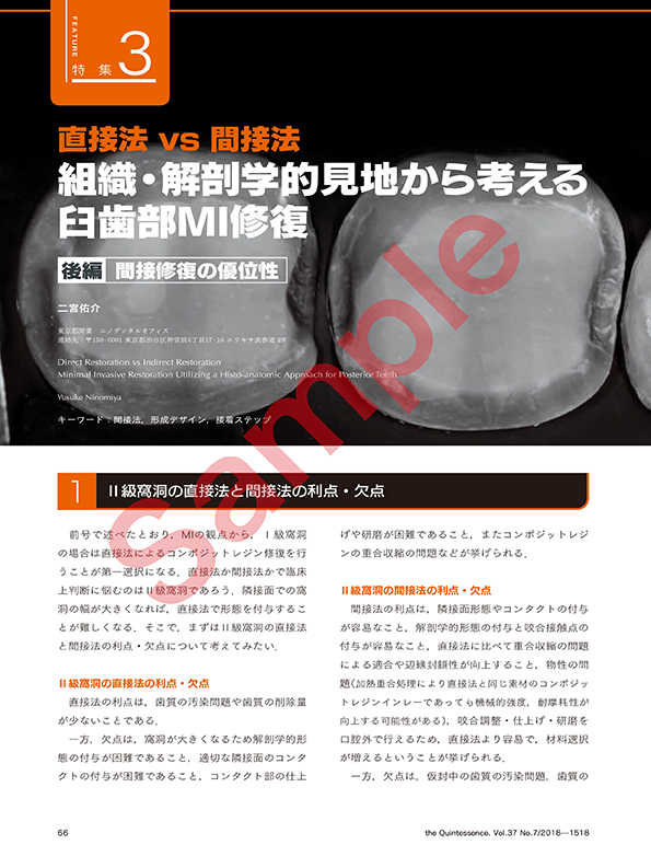 直接法vs間接法 組織・解剖学的見地から考える臼歯部MI修復 後編：間接修復の優位性

