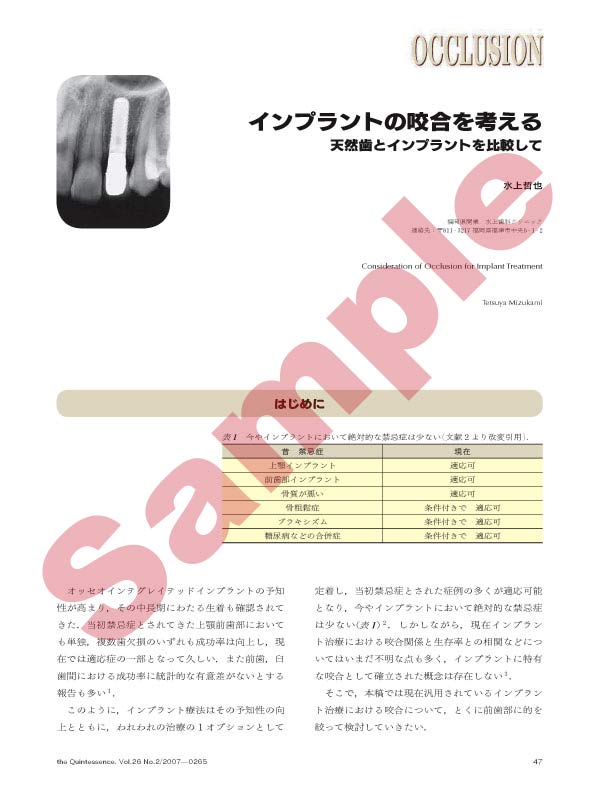 インプラントの咬合