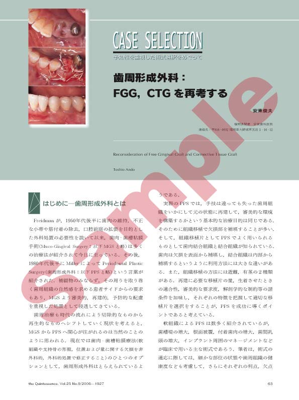 CASE SELECTION:歯周形成外科:FGG、CTGを再考する - クインテッセンス出版