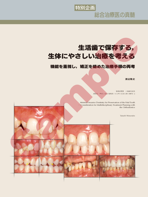 特別企画：総合治療医の真髄：生活歯で保存する，生体にやさしい治療を