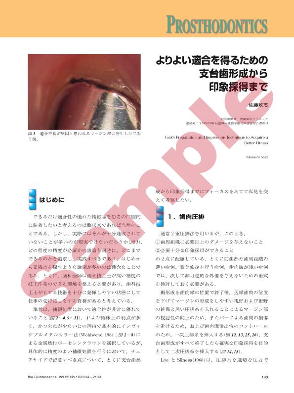 PROSTHODONTICS:よりよい適合を得るための支台歯形成から印象採得まで