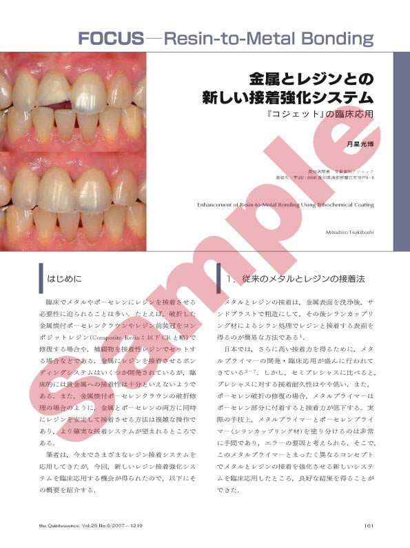 鑑別診断と治療計画立案の臨床アドバイス：咬合と中等度歯周疾患